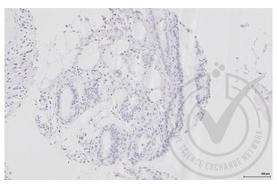 Immunohistochemistry validation image for anti-Aquaporin 2 (Collecting Duct) (AQP2) (AA 171-271) antibody (ABIN707576)