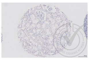 Immunohistochemistry validation image for anti-Dishevelled Segment Polarity Protein 1 (DVL1) (AA 21-100) antibody (ABIN670671)