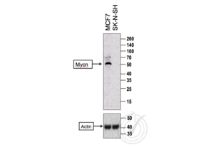 Western Blotting validation image for anti-N-Myc Proto-Oncogene Protein (MYCN) (AA 401-464) antibody (ABIN760676) (MYCN Antikörper  (AA 401-464))