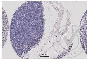 Immunohistochemistry validation image for anti-Tight Junction Protein 1 (TJP1) (AA 1551-1702) antibody (ABIN675024)