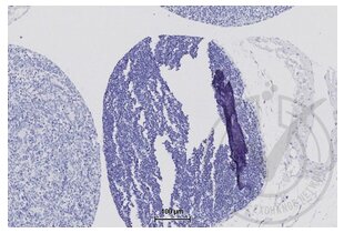 Immunohistochemistry validation image for anti-Tight Junction Protein 1 (TJP1) (AA 1551-1702) antibody (ABIN675024)