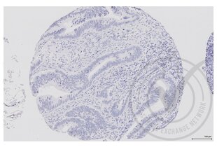 Immunohistochemistry validation image for anti-V-Raf-1 Murine Leukemia Viral Oncogene Homolog 1 (RAF1) (AA 31-130) antibody (ABIN733208)