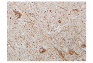 Immunohistochemistry validation image for anti-Wingless-Type MMTV Integration Site Family Member 2 (WNT2) (AA 221-320) antibody (ABIN762896)