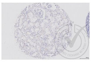 Immunohistochemistry validation image for anti-Wingless-Type MMTV Integration Site Family, Member 2B (WNT2B) (AA 301-391) antibody (ABIN675728)