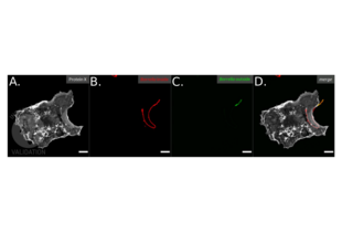 Immunofluorescence validation image for anti-Borrelia Burgdorferi antibody (ABIN236885) (Borrelia Burgdorferi Antikörper)