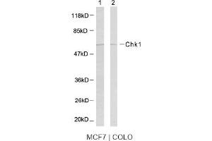 Image no. 2 for anti-Checkpoint Kinase 1 (CHEK1) (Ser317) antibody (ABIN197292) (CHEK1 Antikörper  (Ser317))