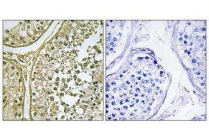 Immunohistochemistry (IHC) image for anti-Casein Kinase 1, alpha 1-Like (CSNK1A1L) (Internal Region) antibody (ABIN1849778) (CSNK1A1L Antikörper  (Internal Region))