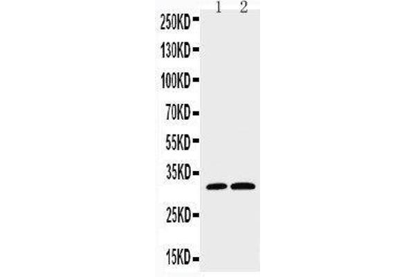 Caspase 3 Antikörper  (C-Term)