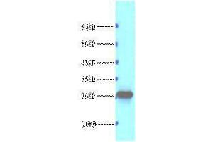 Western Blotting (WB) image for anti-B-Cell CLL/lymphoma 2 (BCL2) antibody (ABIN3178594) (Bcl-2 Antikörper)