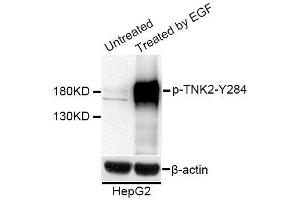 Western blot analysis of extracts of HepG2 cells, using Phospho-TNK2-Y284 antibody (ABIN5995622) at 1/1000 dilution. (TNK2 Antikörper  (pTyr284))