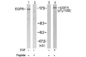 Image no. 2 for anti-Epidermal Growth Factor Receptor (EGFR) (Tyr1092) antibody (ABIN197231) (EGFR Antikörper  (Tyr1092))