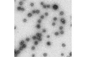 Transmission electron microscopy (TEM) image for Human Papilloma Virus 16 Capsid Protein (HPV-16 L1) protein-VLP (ABIN7540349)