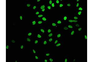 Immunofluorescence (IF) image for anti-Histone Cluster 1, H4a (HIST1H4A) (acLys16) antibody (ABIN7127270)