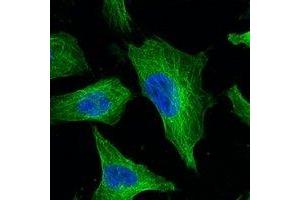 Immunofluorescent analysis of Beta-tubulin staining in Hela cells. (TUBB Antikörper)