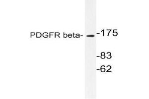 Western blot (WB)analyzes of PDGFR beta antibody in extracts from NIH/3T3 cells. (PDGFRB Antikörper)