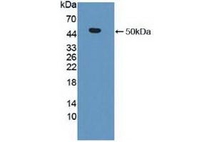 Western blot analysis of recombinant Human MMP19. (MMP19 Antikörper  (AA 98-508))