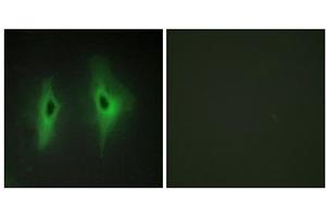 Immunofluorescence analysis of HeLa cells, using DGKH antibody. (DGKH Antikörper  (Internal Region))