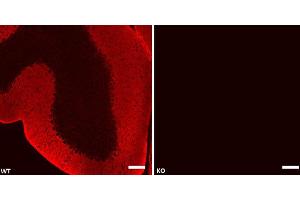 Immunohistochemistry (IHC) image for anti-Solute Carrier Family 1 (Glial High Affinity Glutamate Transporter), Member 3 (SLC1A3) (Cytoplasmic Domain) antibody (ABIN2690503)