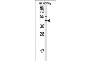Western blot analysis of anti-GJA8 Antibody in mouse kidney tissue lysates (35ug/lane) (GJA8 Antikörper  (C-Term))