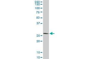 CNOT7 monoclonal antibody (M01A), clone 2F6. (CNOT7 Antikörper  (AA 1-285))