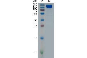 IFNAR1 Protein (AA 28-436) (Fc Tag)