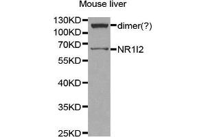 Western Blotting (WB) image for anti-Nuclear Receptor Subfamily 1, Group I, Member 2 (NR1I2) (AA 100-200) antibody (ABIN3015525) (NR1I2 Antikörper  (AA 100-200))