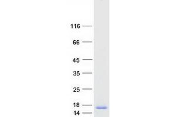 FXYD2 Protein (Transcript Variant B) (Myc-DYKDDDDK Tag)