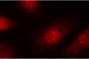 Immunofluorescence (IF) image for anti-Retinoblastoma 1 (RB1) (pSer780) antibody (ABIN1870571) (Retinoblastoma 1 Antikörper  (pSer780))