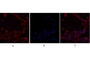 Immunofluorescence analysis of human lung tissue. (IRS1 Antikörper)