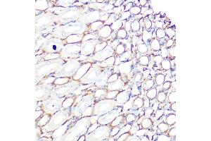 Immunohistochemistry of paraffin-embedded mouse kidney using Filamin A Rabbit mAb (ABIN1682545, ABIN3018024, ABIN3018025 and ABIN7101570) at dilution of 1:100 (40x lens). (Filamin A Antikörper)