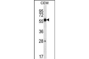 Western blot analysis in CEM cell line lysates (35ug/lane). (ZNF764 Antikörper  (AA 84-113))