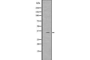 Western blot analysis of Spermidine using Jurkat whole  lysates. (Spermidine Synthase Antikörper  (Internal Region))