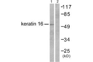 Western Blotting (WB) image for anti-Keratin 16 (KRT16) (C-Term) antibody (ABIN1848628) (KRT16 Antikörper  (C-Term))