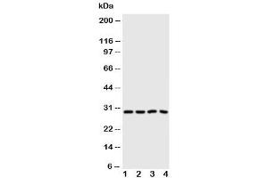 Western blot testing of Carbonic Anhydrase III antibody and Lane 1:  SMMC-7721 (CA3 Antikörper  (N-Term))