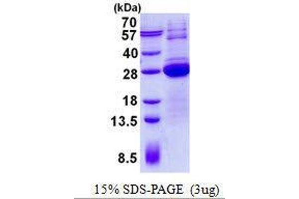 LSM12B Protein