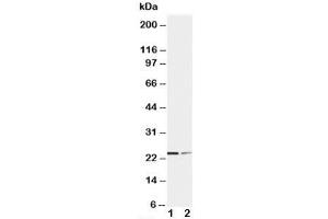 Western blot testing of SOCS1 antibody and Lane 1:  HT1080;  2: COLO320 cell lysate. (SOCS1 Antikörper  (C-Term))