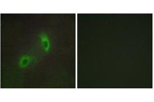 Immunofluorescence analysis of HUVEC cells, using HGS antibody. (HGS Antikörper  (Internal Region))