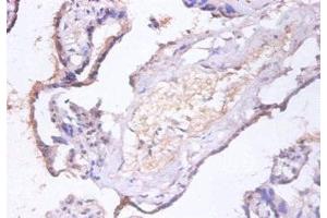 Immunohistochemistry of paraffin-embedded human placenta tissue using ABIN7147519 at dilution of 1:100 (CHMP2A Antikörper  (AA 1-222))