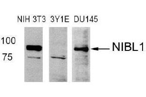 Western blot analysis of extract from NIH3T3 (Mouse), 3Y1E (Rat), DU145 (Human) cells using Niban like protein 1(Ab-712) antibody (E021332). (MEG3 Antikörper)