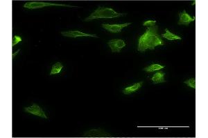 Immunofluorescence of monoclonal antibody to HDAC6 on HeLa cell. (HDAC6 Antikörper  (AA 1-1063))