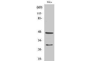 Western Blotting (WB) image for anti-Cathepsin D (CTSD) (Internal Region) antibody (ABIN3174201) (Cathepsin D Antikörper  (Internal Region))