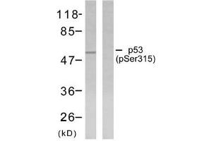 Western blot analysis of extracts from ovary cancer cells using p53 (phosphor-Ser315) antibody (E011100). (p53 Antikörper  (pSer315))