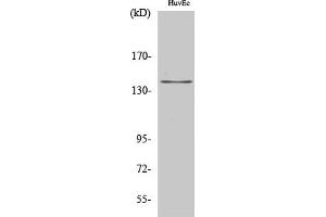 Western Blot analysis of HuvEc cells using Amyloid-β Polyclonal Antibody diluted at 1:2000. (beta Amyloid Antikörper)