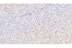 Detection of MFRN in Human Liver Tissue using Polyclonal Antibody to Mitoferrin (MFRN) (SLC25A37 Antikörper  (AA 65-338))