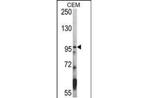 Western blot analysis of hHDAC7-A935 in CEM cell line lysates (35ug/lane) (HDAC7 Antikörper  (C-Term))
