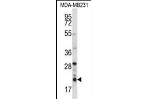 HIST1H1D Antibody (Center) (ABIN657667 and ABIN2846660) western blot analysis in MDA-M cell line lysates (35 μg/lane). (Histone H1.3 Antikörper  (AA 135-164))