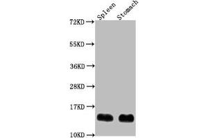 Western Blot Positive WB detected in: Mouse spleen tissue, Mouse stomach tissue All lanes: B2m antibody at 1:2000 Secondary Goat polyclonal to rabbit IgG at 1/50000 dilution Predicted band size: 14 kDa Observed band size: 14 kDa (beta-2 Microglobulin Antikörper  (AA 21-119))