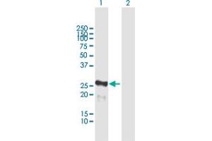 Western Blot analysis of MIS12 expression in transfected 293T cell line by MIS12 MaxPab polyclonal antibody. (MIS12 Antikörper  (AA 1-205))