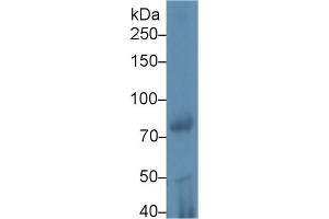 Western blot analysis of Rat Testis lysate, using Mouse iPLA2 Antibody (1 µg/ml) and HRP-conjugated Goat Anti-Rabbit antibody ( (PNPLA2 Antikörper  (AA 481-702))