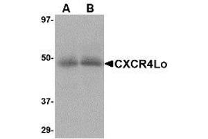 Image no. 1 for anti-Chemokine (C-X-C Motif) Receptor 4 (CXCR4) (N-Term) antibody (ABIN1493919) (CXCR4 Antikörper  (N-Term))